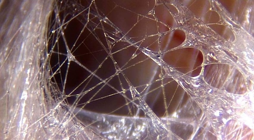 Fascia web